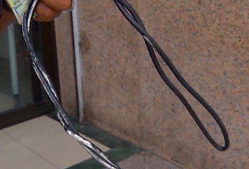 Mujer fue golpeada por su pareja con un cable