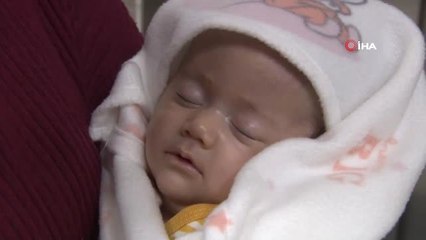 Doktorların "Aldırın" Dediği Yağmur Bebek Tıp Literatürüne Girebilir