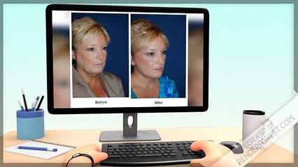 Deep Plane Facelift Surgeon | Only Faces By Dr. Sean Freeman
