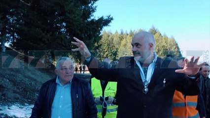 TRANSFORMOHET NE TIRANE KLINIKA E SPECIALIZUAR E MUSHKERIVE - News, Lajme - Kanali 7