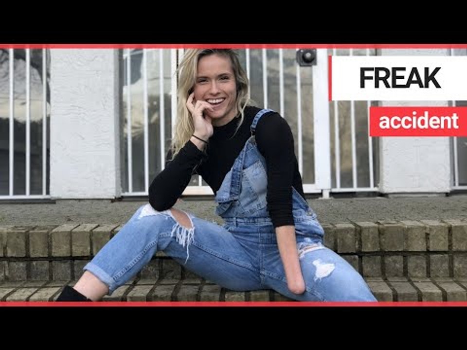 Dancer poses for selfie hours before her hand is ripped off in a freak accident | SWNS TV