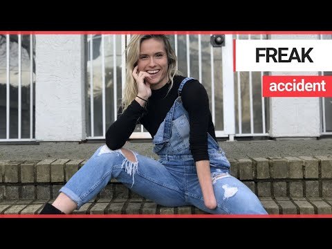 Dancer poses for selfie hours before her hand is ripped off in a freak accident | SWNS TV