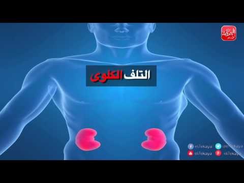 شووف الحكاية| هذا الطعام فيه سم قاتل اخطر 10 أسباب للإمتناع عن الملح والسكر