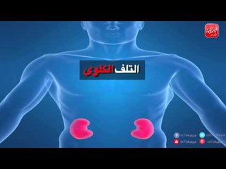 شووف الحكاية| هذا الطعام فيه سم قاتل اخطر 10 أسباب للإمتناع عن الملح والسكر