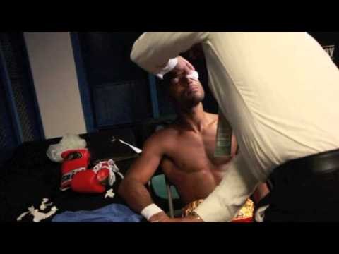 NEW IBF WELTERWEIGHT CHAMPION KELL BROOK BEING STITCHED UP AFTER PORTER WIN IN CARSON