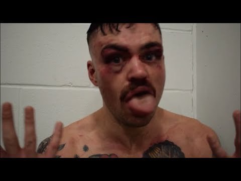 'FURY WILL FRUSTRATE WILDER' - TYRONE McKENNA REACTS TO NARROW WIN OVER LEWIS BENSON & WILDER/FURY