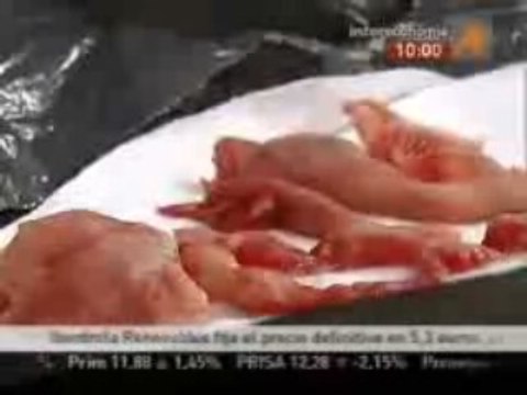 Intereconomía recibe una bolsa con restos de un feto humano de una clínica abortiva