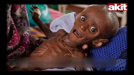 Kızılay Genel Başkanı Kınık: Yemen'de çocuklar açlıktan ölürken biz ekmek israf ediyoruz