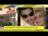 Mujer de 47 años quemada por su pareja en Quilmes