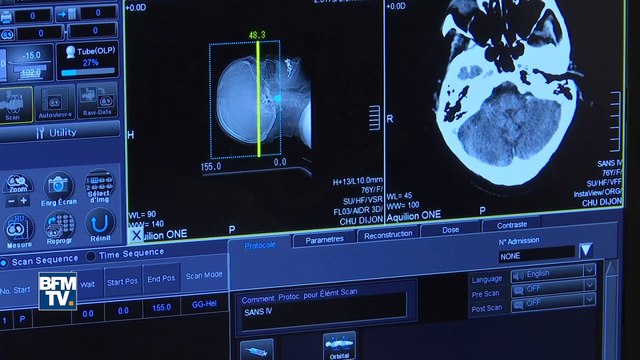 Santé : le CHU de Dijon s’équipe d’un scanner doté d’intelligence artificielle