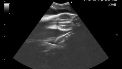 Echographie d'une femelle  requin nourrice fauve