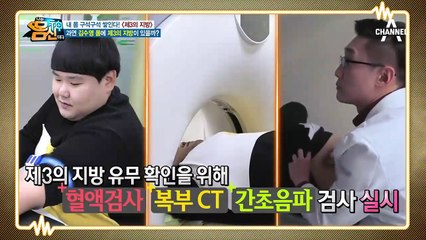 개그맨 대표 통통이(?) 김수영! 그의 몸에도 제3의 지방이?!