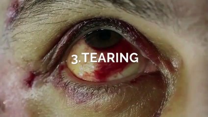 Come Let's Deal With Eye Allergy Symptoms...