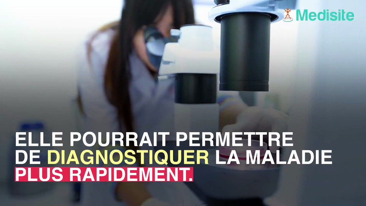Cancer du pancréas :  un test génétique pour le dépister plus tôt
