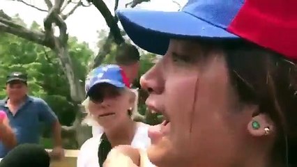 Jovem venezuelana ferida torna-se viral pelo "motivo" errado