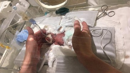 Au Japon, le plus petit bébé du monde est sorti de l'hôpital