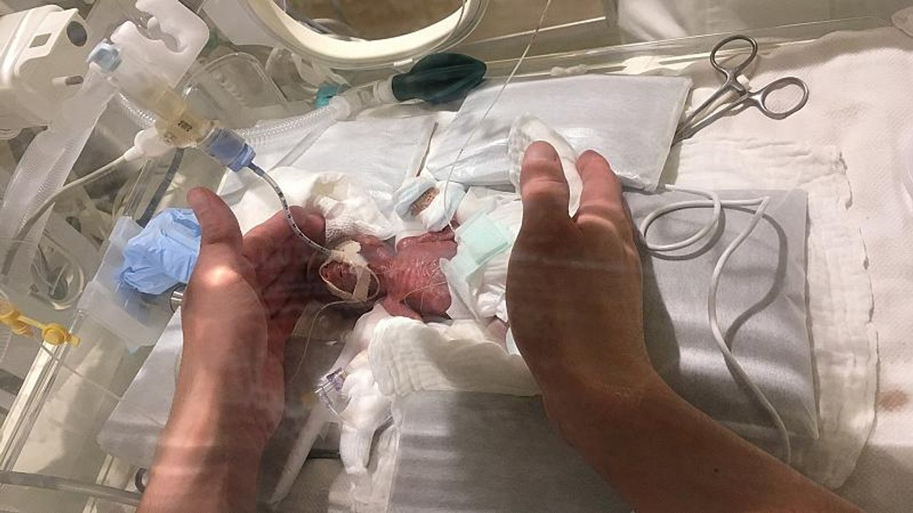Japan: 268 Gramm - weltweit kleinster Junge überlebt