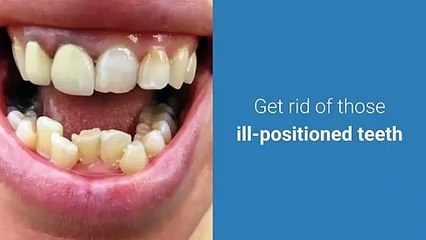Invisalign Dentist Little Rock | smiledailey.com | Phone: 501 448 0032