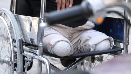 رامز القحطاني فقد ساقيه لتبقى تعز واقفة