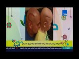 صباح الورد | - امريكي يرسم تاتو علي رأسه تضامناً مع ابنه مريض السرطان