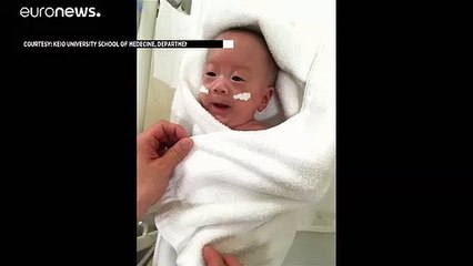 شاهد: أصغر رضيع في العالم يخرج من مستشفى باليابان