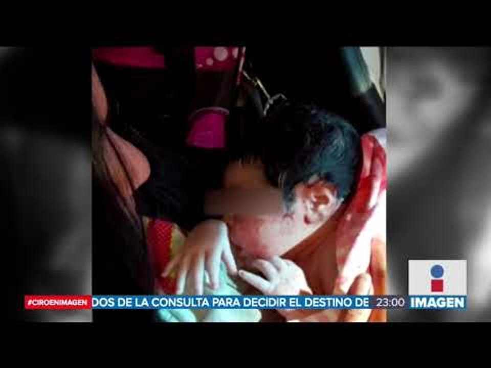 Médicos muestran creatividad al intentar salvar vidas | Noticias con Ciro Gómez Leyva