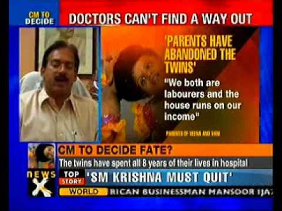 AP govt to decide abandoned conjoined twins future