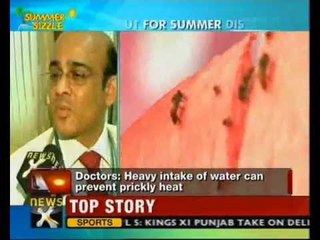 Summer Sizzle: Protect yourself against health hazards - NewsX