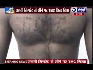 TMC supporters tortured BJP men