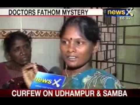 NewsX: 3 Month old Chennai baby bursts into flames whenever he sweats