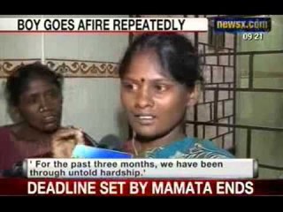 NewsX: Rare medical condition sets Chennai baby boy afire repeatedly