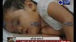 Jammu & Kashmir: 14 Months old Pari injured in Pakistan's mortar attack