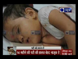 Jammu & Kashmir: 14 Months old Pari injured in Pakistan's mortar attack