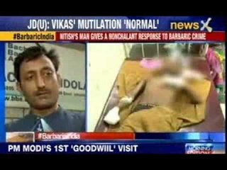 Bihar govt. still not taking any action to curb barabarism after acid attack on Vikas Yadav