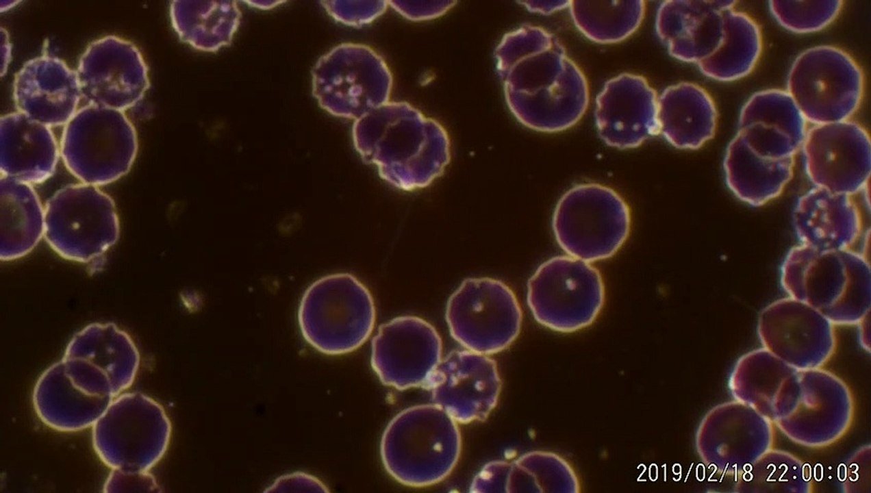 BLOODY MICROSCOPE 004