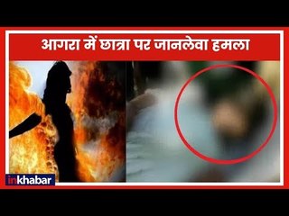 आगरा में छात्रा को छेड़छाड़ का विरोध करने पर जिंदा जलाने की कोशिश हुई, दिल्ली में तोड़ा दम