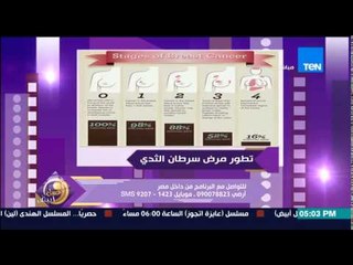 عسل أبيض - الخطوة الثانية من إكتشاف مرض سرطان الثدي ونسبة الشفاء تصل فيه إلى 98%