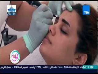 قمر 14 - باكينام الحسيني -  تصحيح عيوب الحواجب لجهاد  بتاتو الحواجب