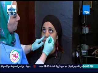 قمر 14 - د/طاهرة لهيطة تكشف  علاج بشرة جهاد وتغير الأنف بدون أى جرحة