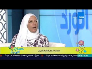 صباح الورد - أ/رشا أنور توضح بالصور كيف يرى الشخص المصاب بـ"متلازمة إرلن"