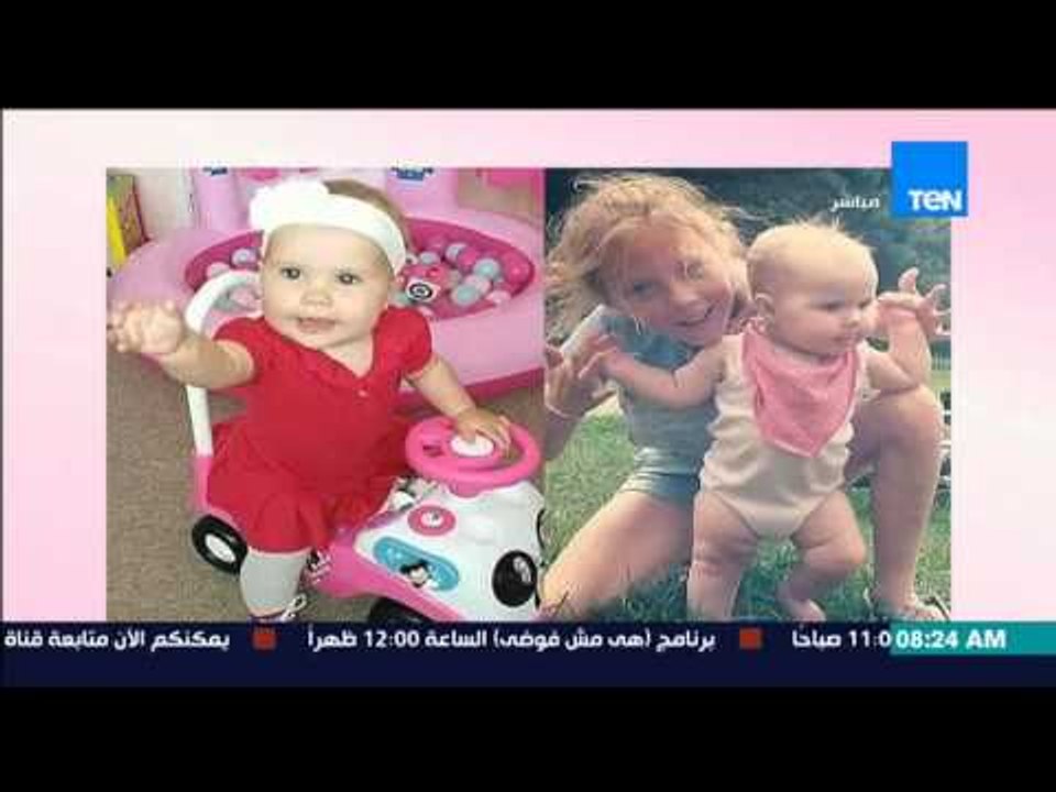 صباح الورد - بالصور .. أطراف صناعية تعيد الأمل لطفلة مصابة بـ "الإلتهاب السحائي"