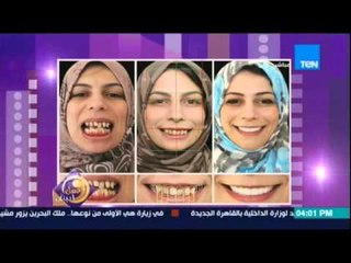 احدث صيحات تجميل الاسنان