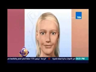 عسل ابيض | ازالة التجاعيد بالليزر