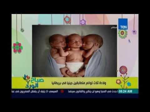 صباح الورد | Sabah El Ward - في حالة نادرة .. ولادة 3 توائم متطابقين جينيًا في بريطانيا