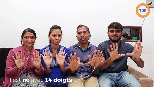 14 doigts, 14 orteils : l’homme aux plus de doigts au monde a toujours peur de se les couper !