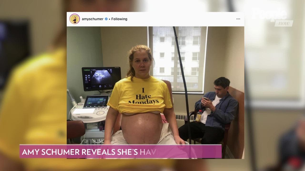 It'll Be a Boy for Amy Schumer and Husband Chri...