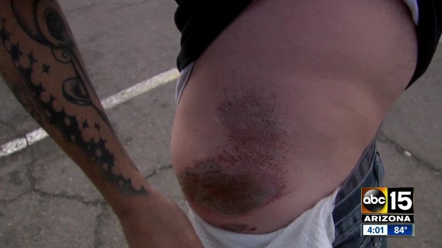 Valley man dragged attempting to stop alleged drunk driver