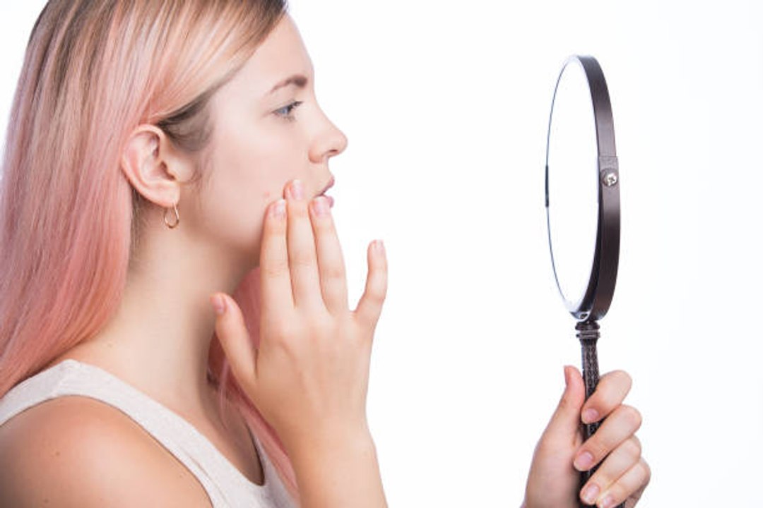 Diese Lebensmittel verursachen Pickel