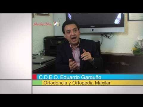 ¿Quiénes son candidatos a cirugía ortodóncica?