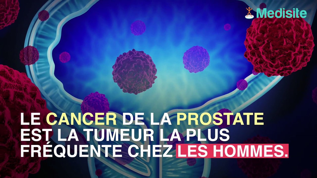 Cancer de la prostate : le traitement hormonal...